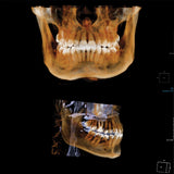 2021 KaVo OP 3D Digital CBCT Panoramic X-ray