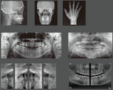 X-era CBCT Cone Beam Panoramic (NEW)