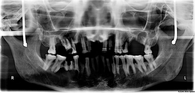 8000Digital Panoramic X-Ray System – Pre-Owned Dental Inc.