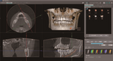 X-era CBCT Cone Beam Panoramic (NEW)