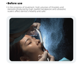 ADS EOS Extraoral Dental Suction System