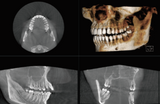 X-era CBCT Cone Beam Panoramic (NEW)