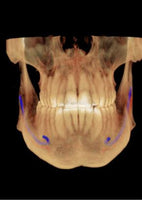 2021 KaVo OP 3D Digital CBCT Panoramic X-ray