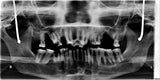 TROPHYPANDigital Panoramic X-Ray System