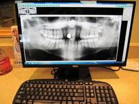 Digital CDR Panx  ( PARTS ONLY)