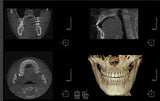 RAYSCAN Alpha Plus CBCT Cone Beam Pan Ceph      RCT700